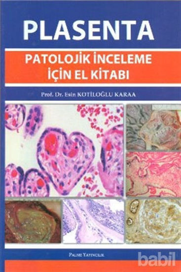 Picture of Plasenta Patolojik İnceleme İçin El Kitabı