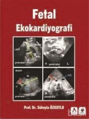 Picture of Fetal Ekokardiyografi