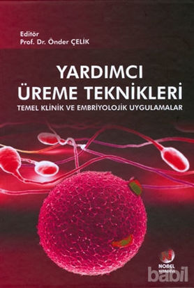 Picture of Yardımcı Üreme Teknikleri