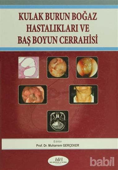 Picture of Kulak Burun Boğaz Hastalıkları Baş Boyun Cerrahisi