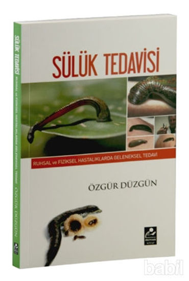 Picture of Ruhsal ve Fiziksel Hastalıklarda Geleneksel Tedavi - Sülük Tedavisi