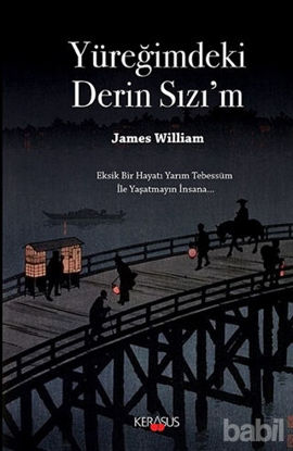 Picture of Yüreğimdeki Derin Sızı'm