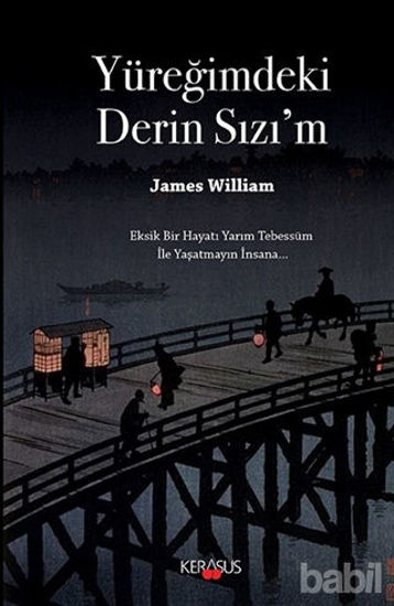 Picture of Yüreğimdeki Derin Sızı'm